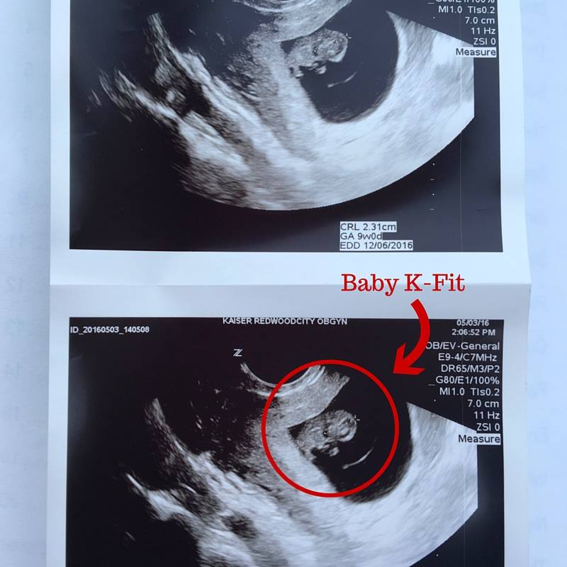 ultrasound with writing